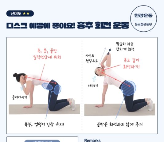 디스크 예방에 좋은 운동