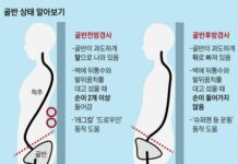 요즘 따라 허리 아프다면… ‘골반 틀어짐’ 확인해보세요