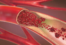 탄력엔 콜라겐 섭취를… 혈관·위장 건강에 도움