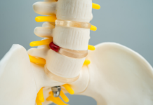 필라테스로 회복해보는 허리디스크 !